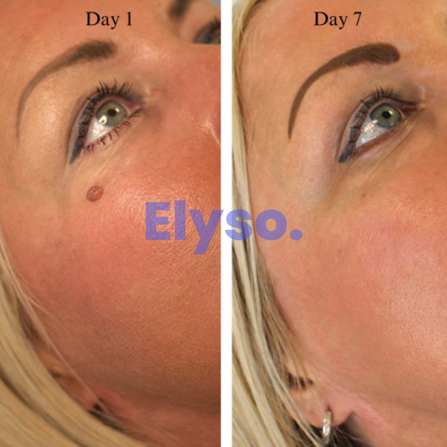 Elyso® PureTag