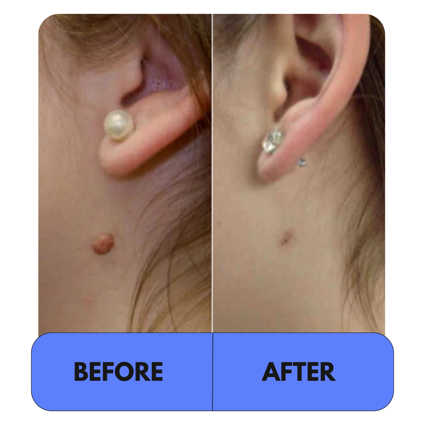 Elyso® 2-1 Tag Buddy