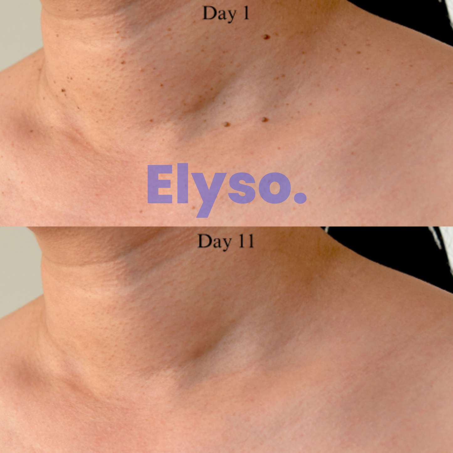 Elyso® PureTag