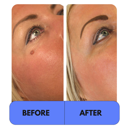 Elyso® 2-1 Tag Buddy