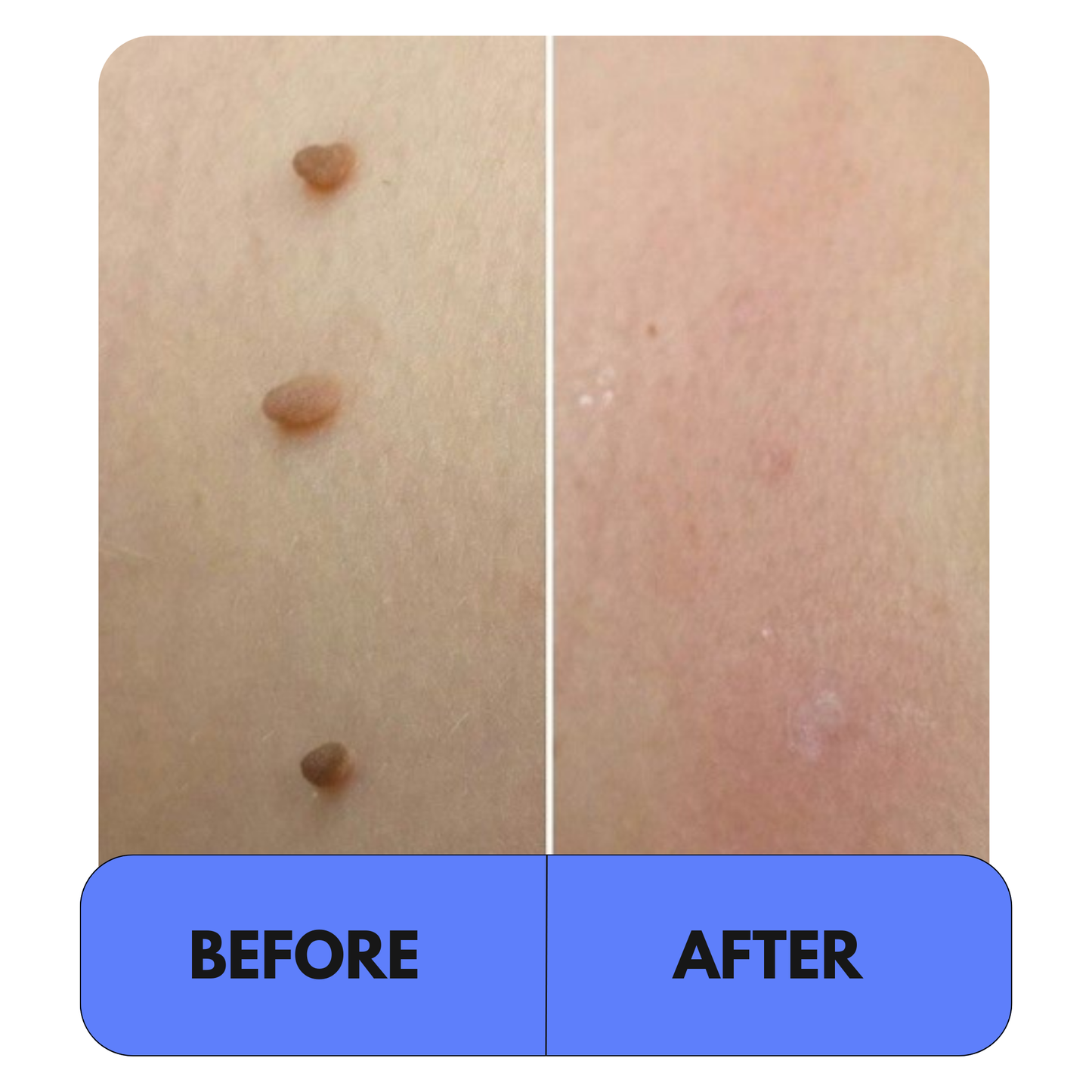 Elyso® 2-1 Tag Buddy