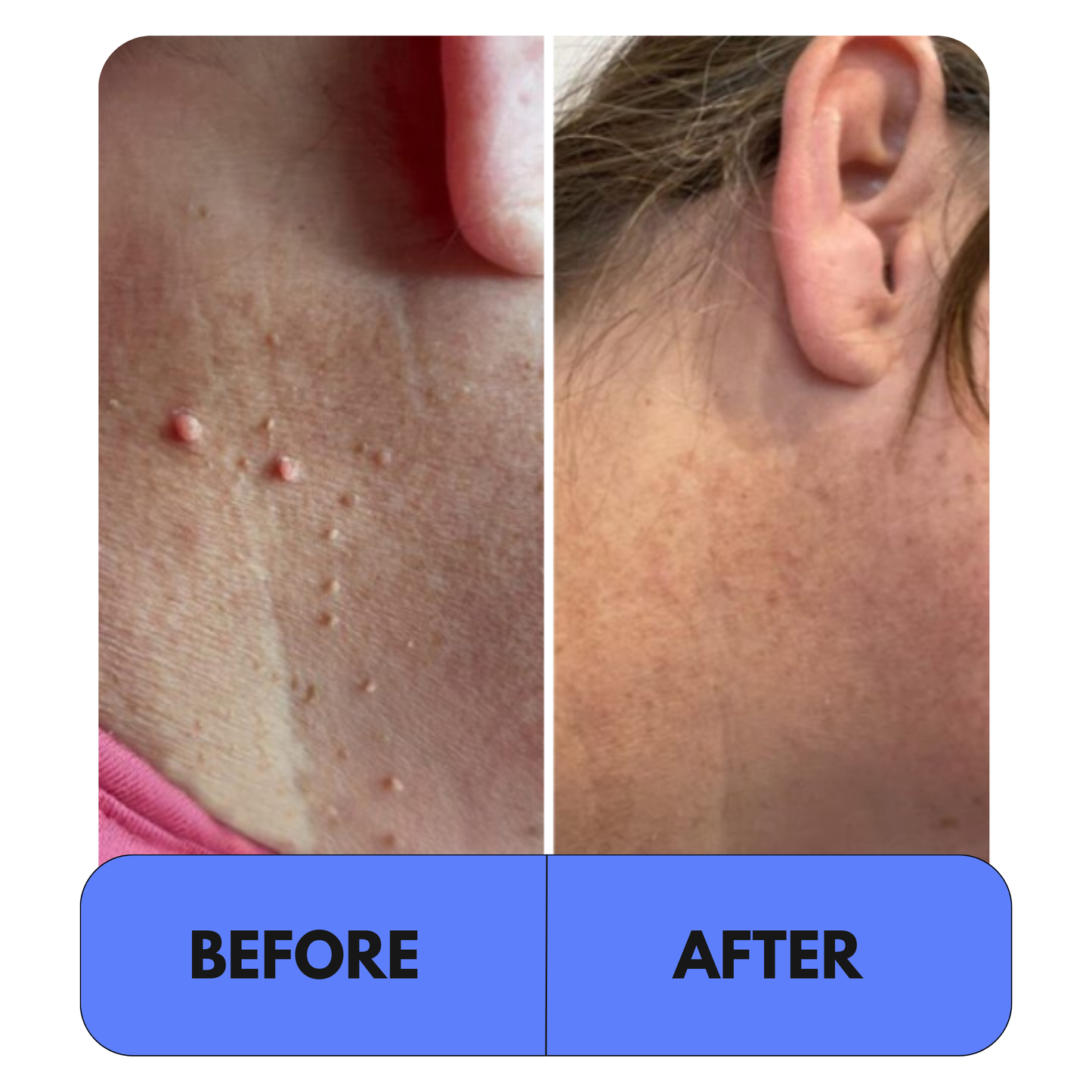 Elyso® 2-1 Tag Buddy