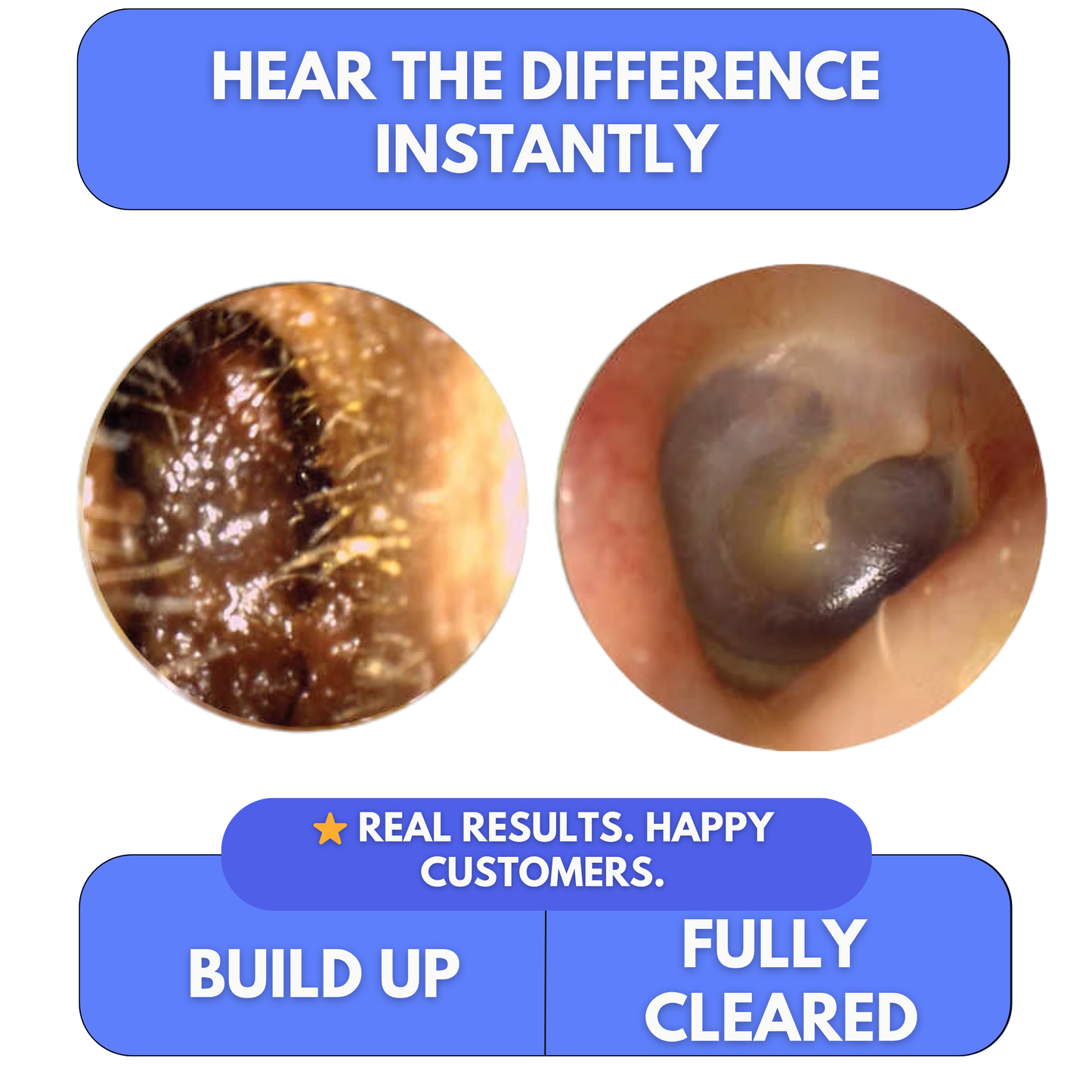 Clear Blocked Ears in Minutes — At Home