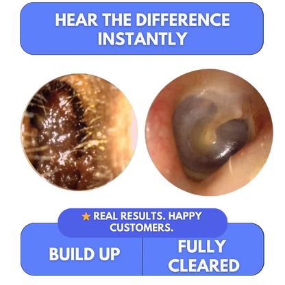 Clear Blocked Ears in Minutes — At Home