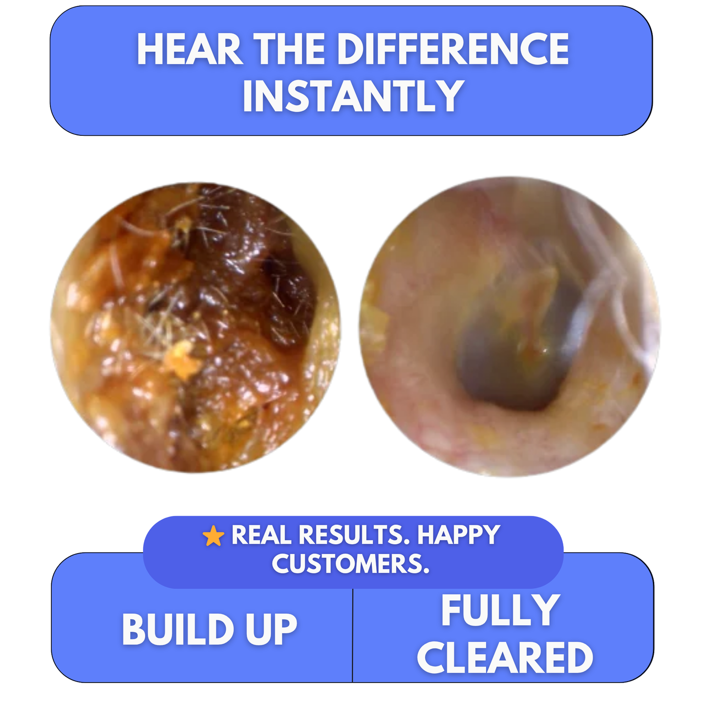 Clear Blocked Ears in Minutes — At Home