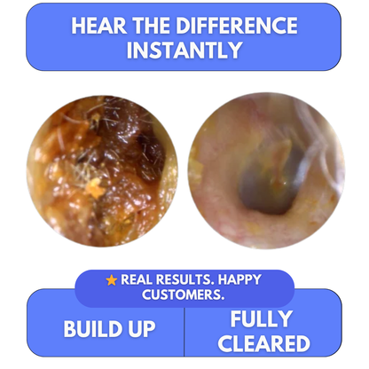 Clear Blocked Ears in Minutes — At Home