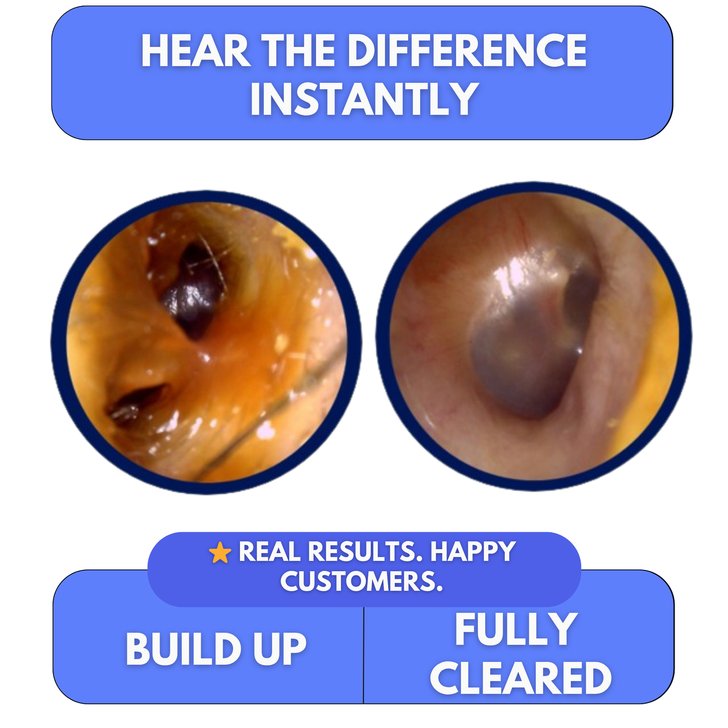 Clear Blocked Ears in Minutes — At Home