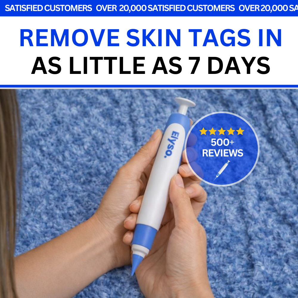 Say Goodbye to Skin Tags — From Home
